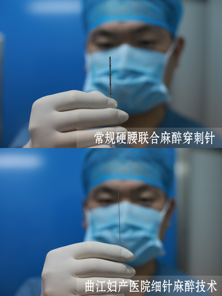 改善剖宫产:改变一只麻醉针,改善多种剖宫产后遗症