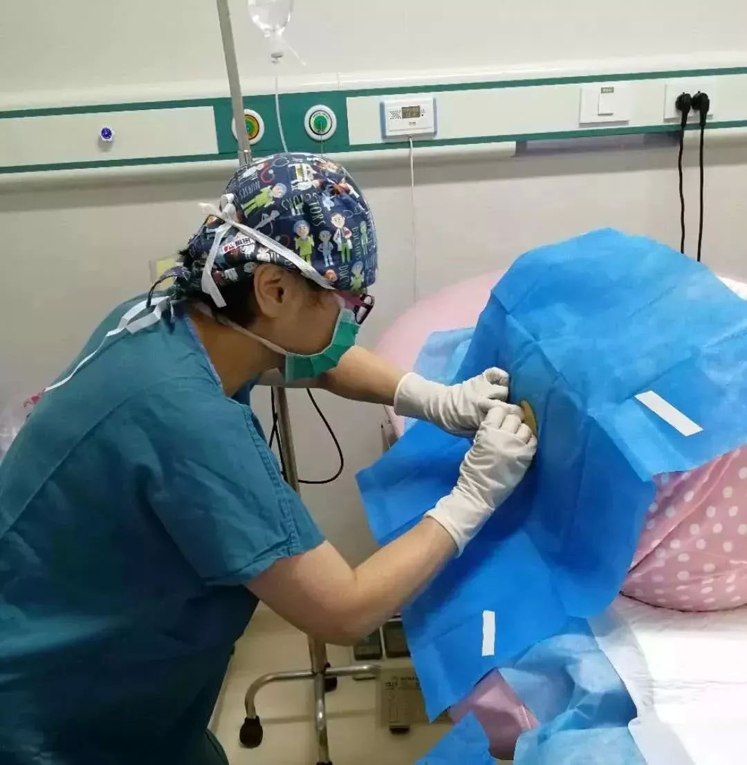 麻醉科主任金伶俐进行脊椎硬膜外腔注射麻醉